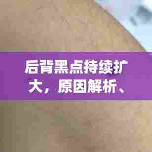 后背黑点持续扩大，原因解析、诊断及治疗方案