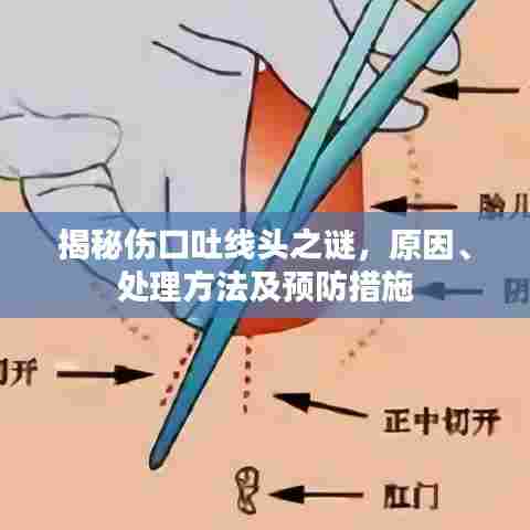 揭秘伤口吐线头之谜，原因、处理方法及预防措施