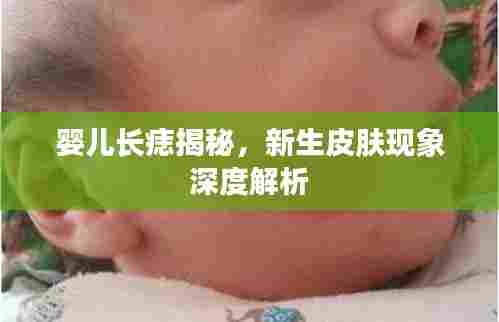 婴儿长痣揭秘，新生皮肤现象深度解析