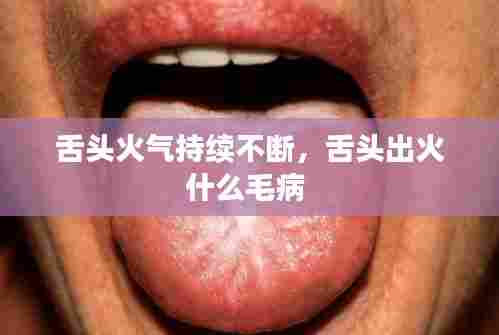 舌头火气持续不断，舌头出火什么毛病 