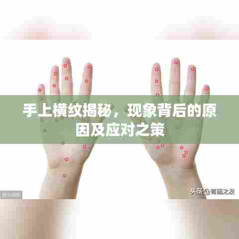 手上横纹揭秘,现象背后的原因及应对之策