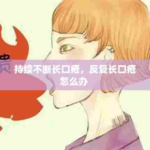 持续不断长口疮，反复长口疮怎么办 