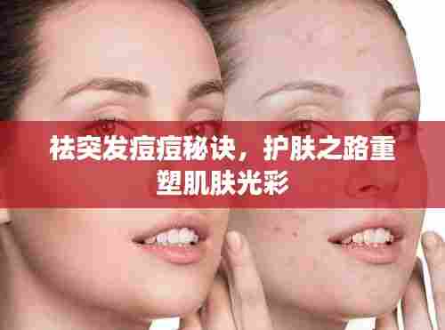 祛突发痘痘秘诀，护肤之路重塑肌肤光彩