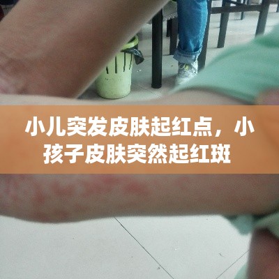 小儿突发皮肤起红点,小孩子皮肤突然起红斑