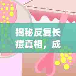 揭秘反复长痘真相,成因解析与应对良方