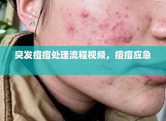 突发痘痘处理流程视频，痘痘应急 