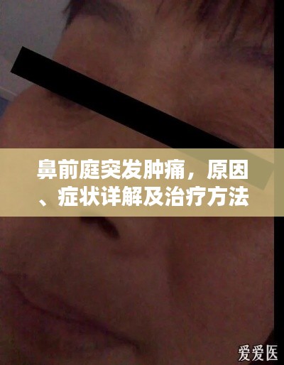 鼻前庭突发肿痛，原因、症状详解及治疗方法探讨