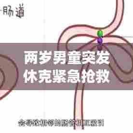 两岁男童突发休克紧急抢救,家长需警惕的背后警示