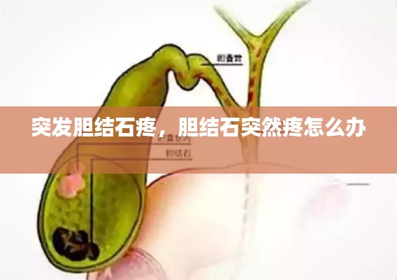 突发胆结石疼,胆结石突然疼怎么办
