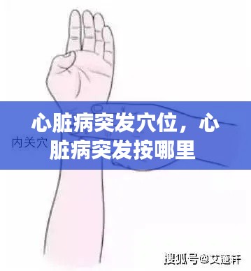 心脏病突发穴位，心脏病突发按哪里 