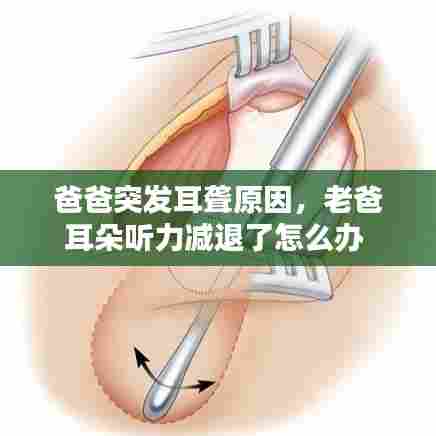 爸爸突发耳聋原因，老爸耳朵听力减退了怎么办 