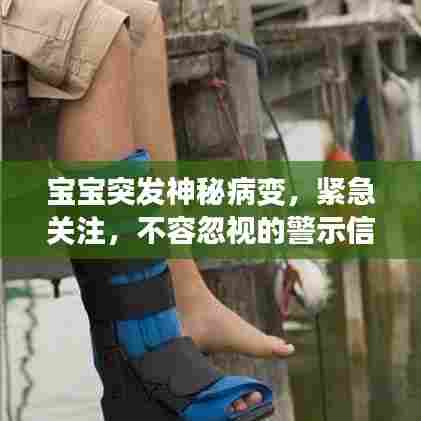 宝宝突发神秘病变，紧急关注，不容忽视的警示信号！
