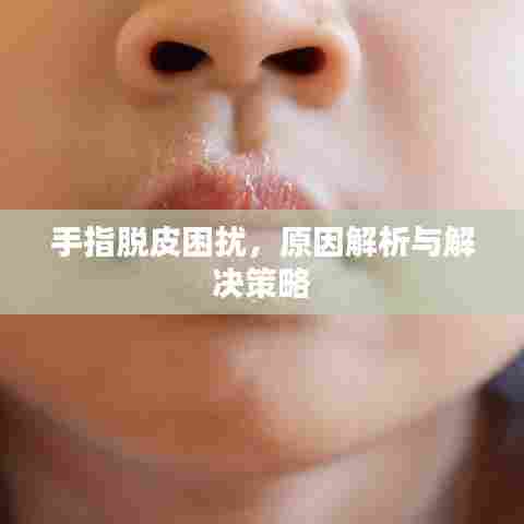 手指脱皮困扰,原因解析与解决策略