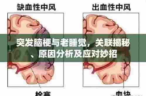 突发脑梗与老睡觉,关联揭秘、原因分析及应对妙招