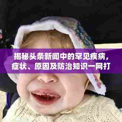 揭秘头条新闻中的罕见疾病,症状、原因及防治知识一网打尽!