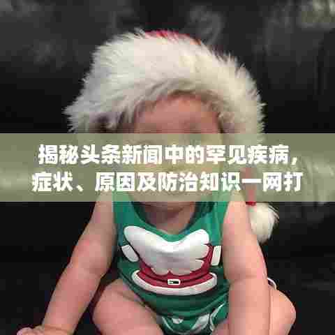 揭秘头条新闻中的罕见疾病,症状、原因及防治知识一网打尽!