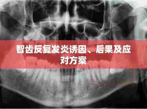 智齿反复发炎诱因、后果及应对方案