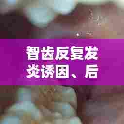 智齿反复发炎诱因、后果及应对方案