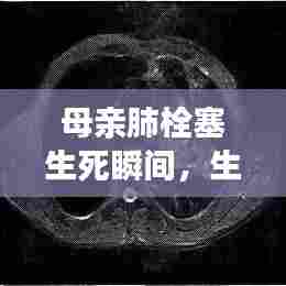 母亲肺栓塞生死瞬间,生命与关爱的深度剖析
