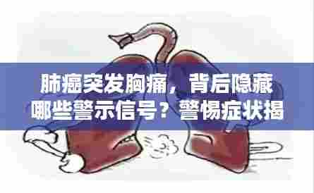 肺癌突发胸痛,背后隐藏哪些警示信号?警惕症状揭示真相!