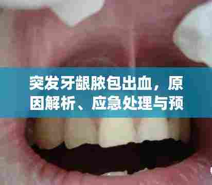 突发牙龈脓包出血，原因解析、应急处理与预防方法全攻略