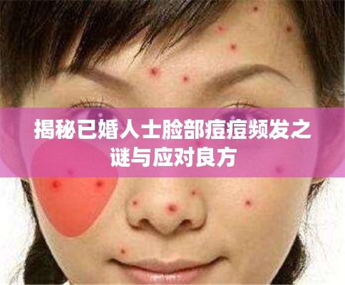 揭秘已婚人士脸部痘痘频发之谜与应对良方