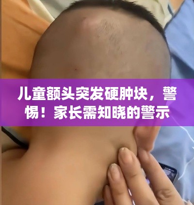 儿童额头突发硬肿块，警惕！家长需知晓的警示信号