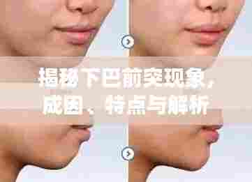 揭秘下巴前突现象,成因、特点与解析